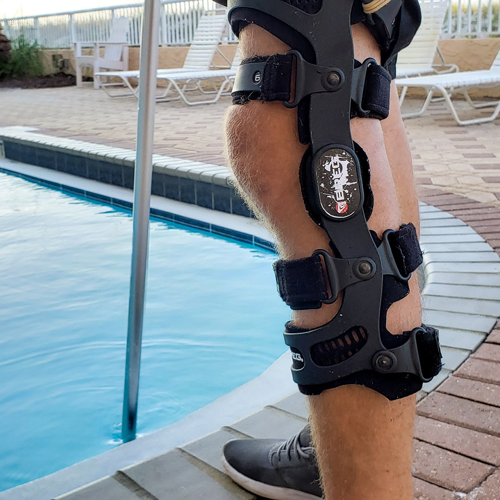 Knee brace providing support and stability, worn by individual near swimming pool, emphasizing custom bracing solutions for pain relief and improved mobility.